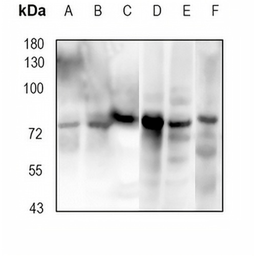 GRK3 Rabbit Monoclonal Antibody(C1843)