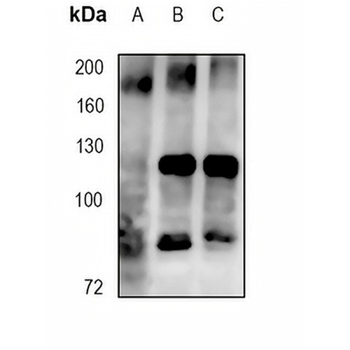 IRS2 Rabbit Monoclonal Antibody(C1844)