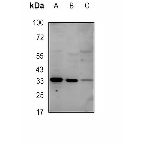 UCP1/3 Rabbit Monoclonal Antibody(C1845)