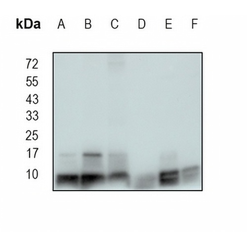 ATP5G1 Rabbit Monoclonal Antibody(C1846)