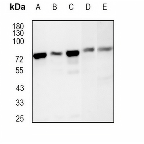 hnRNP M Rabbit Monoclonal Antibody(C1847)