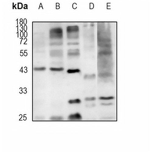KCTD9 Rabbit Monoclonal Antibody(C1848)