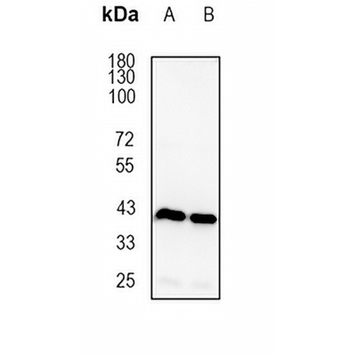 CECR5 Rabbit Monoclonal Antibody(C1849)