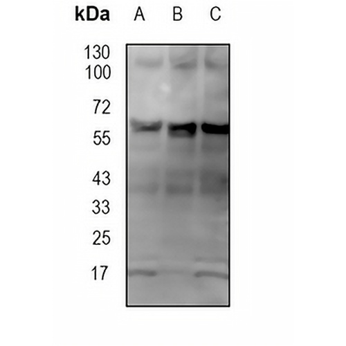 PRPF31 Rabbit Monoclonal Antibody(C1850)