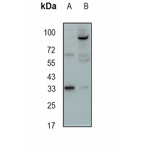 NTHL1 Rabbit Monoclonal Antibody(C1851)