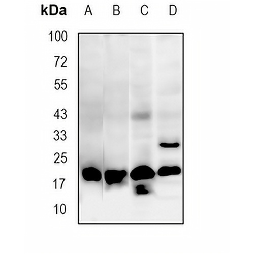 UFC1 Rabbit Monoclonal Antibody(C1852)