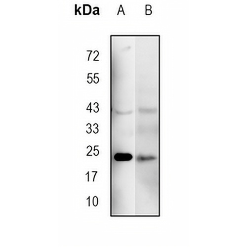 PMF-1 Rabbit Monoclonal Antibody(C1853)