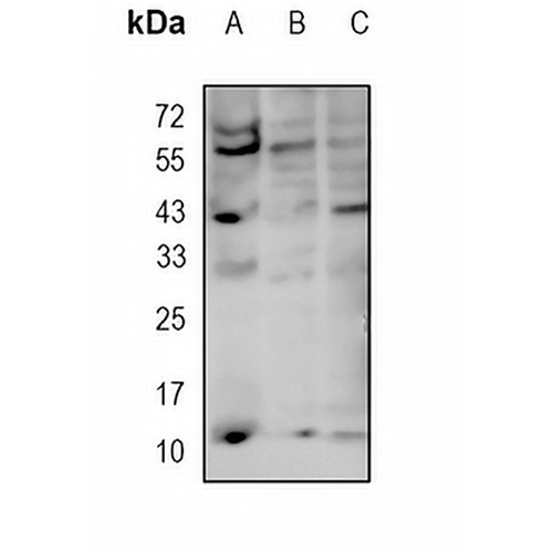 TCTEX-1 Rabbit Monoclonal Antibody(C1855)