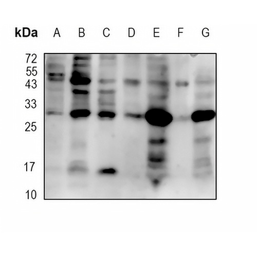 Presenilin 1 Rabbit Monoclonal Antibody(C1856)