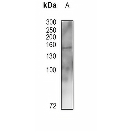 TSC1 Rabbit Monoclonal Antibody(C1857)