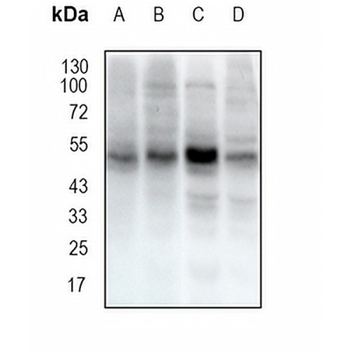 ST13 Rabbit Monoclonal Antibody(C1858)