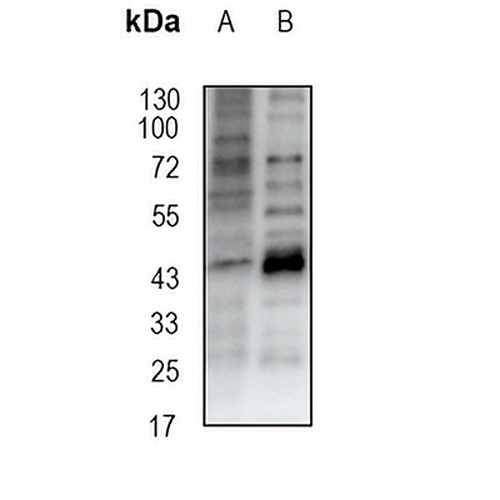 Alpha-galactosidase A Rabbit Monoclonal Antibody(C1859)