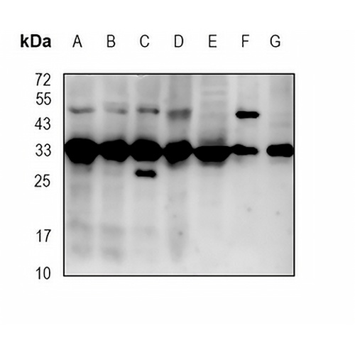Gemin2 Rabbit Monoclonal Antibody(C1860)