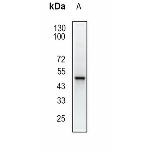 GABRB1 Rabbit Monoclonal Antibody(C1861)