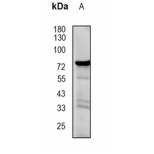 ALOX12 Rabbit Monoclonal Antibody(C1865)