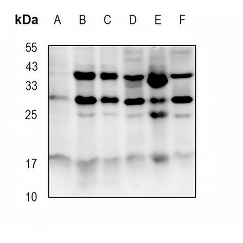CTRL Rabbit Monoclonal Antibody(C1866)