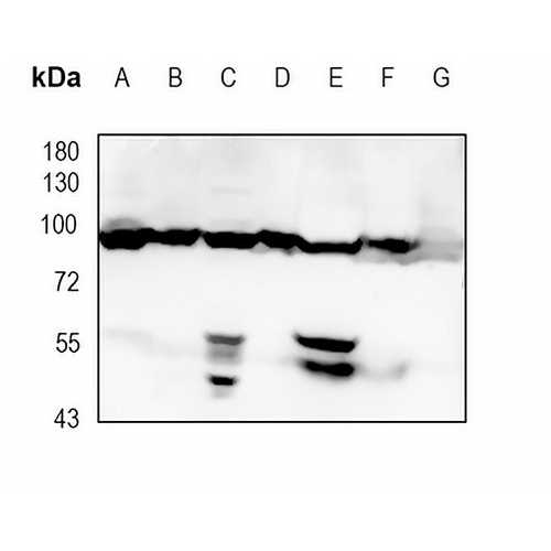 VPS35 Rabbit Monoclonal Antibody(C1867)