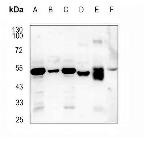 Cytochrome P450 26A1 Rabbit Monoclonal Antibody(C1868)