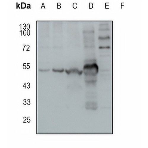 MEIS2 Rabbit Monoclonal Antibody(C1869)