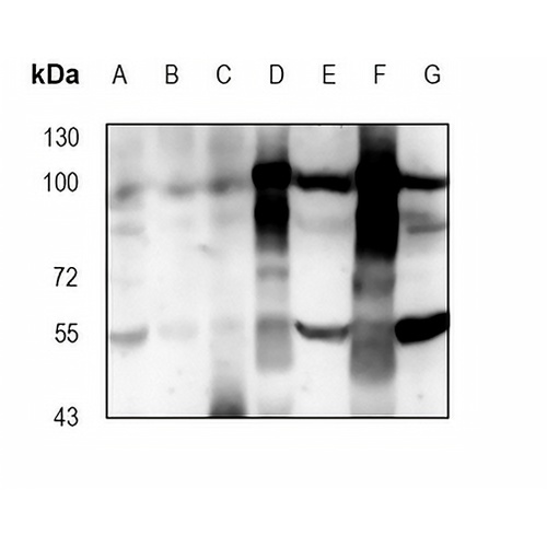ALDH1L1 Rabbit Monoclonal Antibody(C1874)
