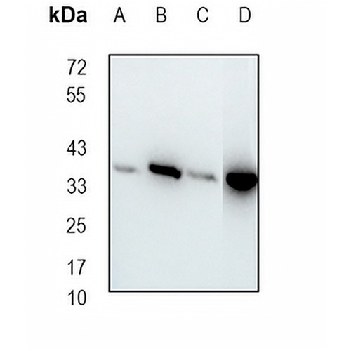 CapG Rabbit Monoclonal Antibody(C1878)