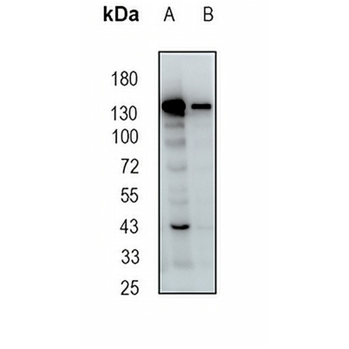 SMC4 Rabbit Monoclonal Antibody(C1879)
