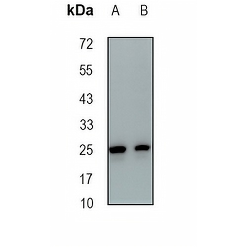 POD-1 Rabbit Monoclonal Antibody(C1880)