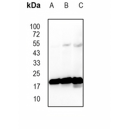 TOM22 Rabbit Monoclonal Antibody(C1881)