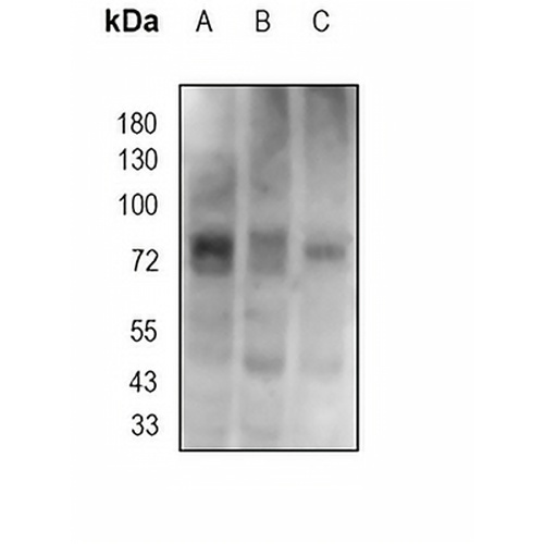 DCP1A Rabbit Monoclonal Antibody(C1882)