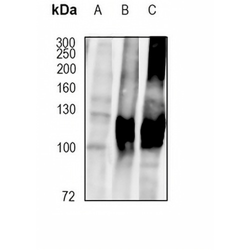 ATP1A3 Rabbit Monoclonal Antibody(C1883)