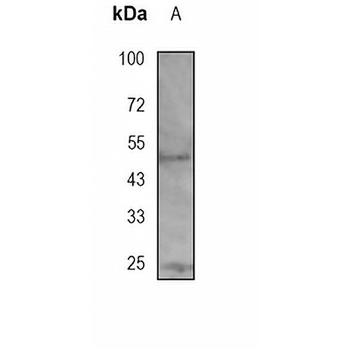 HTRA1 Rabbit Monoclonal Antibody(C1884)