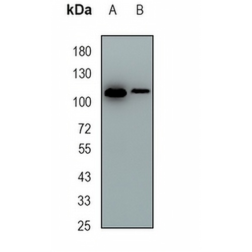 HLTF Rabbit Monoclonal Antibody(C1886)