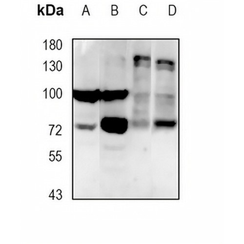 PKC theta Rabbit Monoclonal Antibody(C1887)