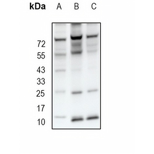 VAMP3 Rabbit Monoclonal Antibody(C1889)