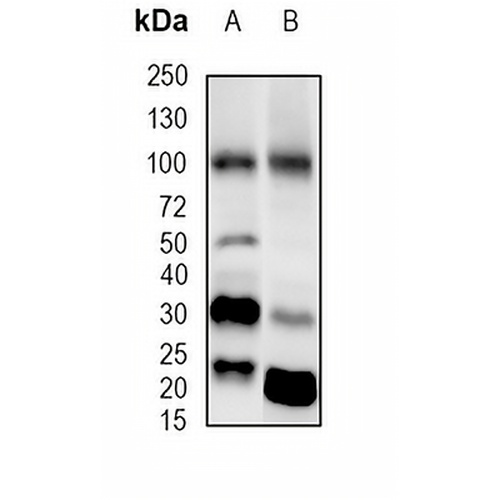 GLUR4 Rabbit Monoclonal Antibody(C1892)