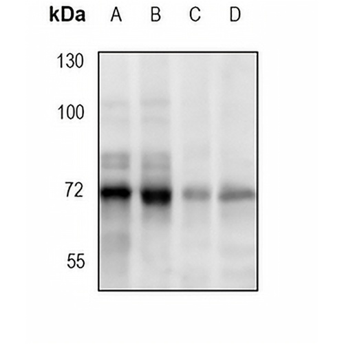 PIAS1 Rabbit Monoclonal Antibody(C1893)