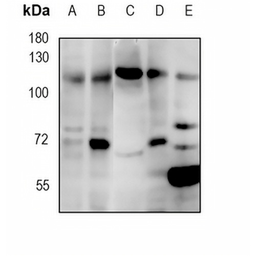 MIB1 Rabbit Monoclonal Antibody(C1894)