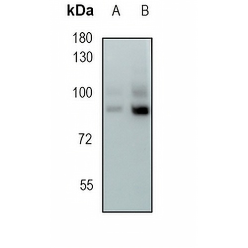 Cullin 4A Rabbit Monoclonal Antibody(C1895)
