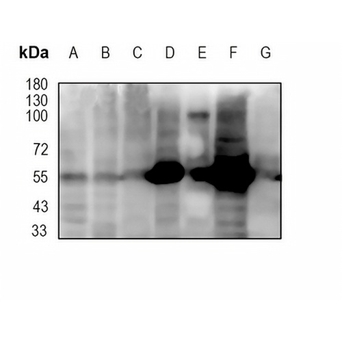 EN1 Rabbit Monoclonal Antibody(C1896)