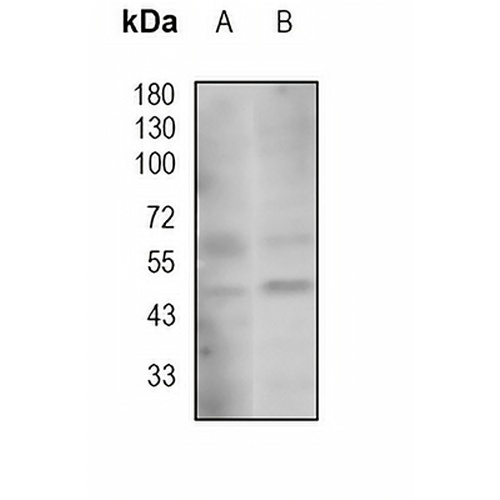 RAD52 Rabbit Monoclonal Antibody(C1897)