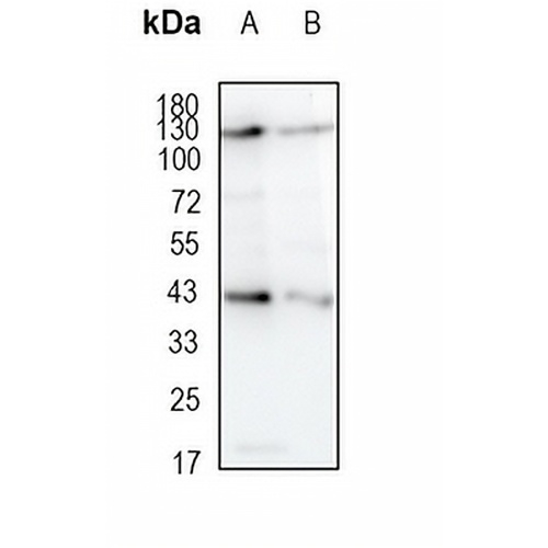 FIH-1 Rabbit Monoclonal Antibody(C1898)