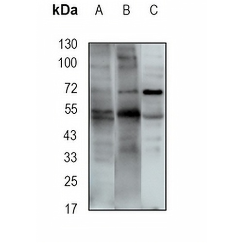 TMPase Rabbit Monoclonal Antibody(C1901)