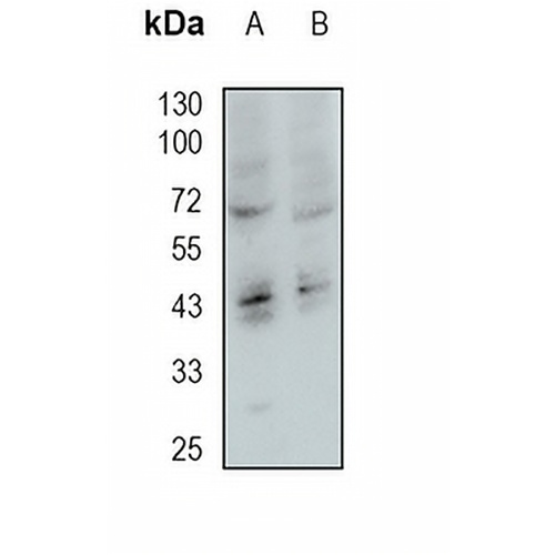 Heparanase Rabbit Monoclonal Antibody(C1902)