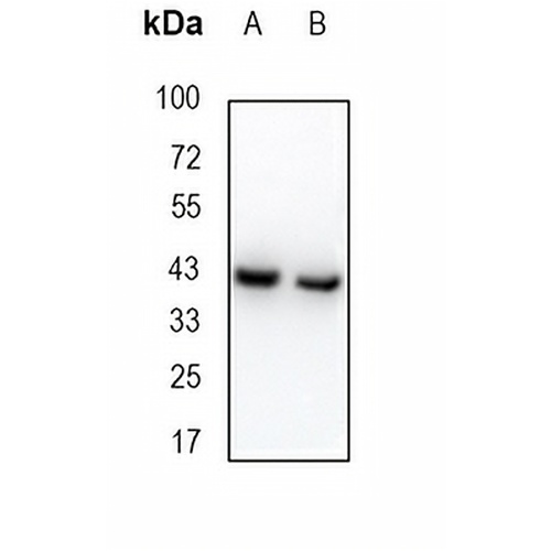 MBNL1 Rabbit Monoclonal Antibody(C1904)