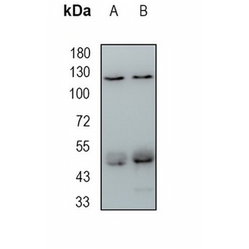 UPF1 Rabbit Monoclonal Antibody(C1905)