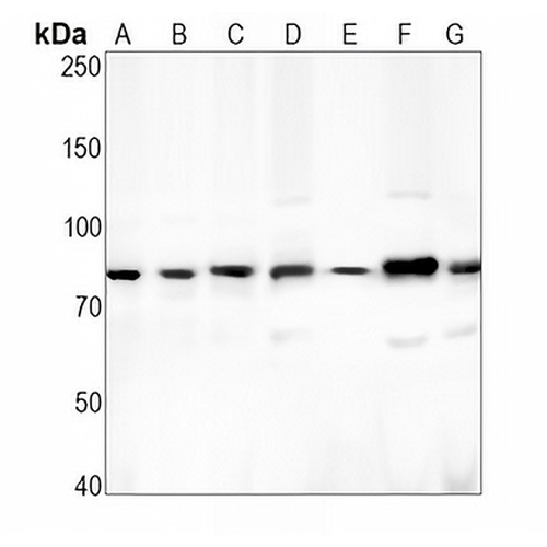 CD265 Rabbit Monoclonal Antibody(C1906)