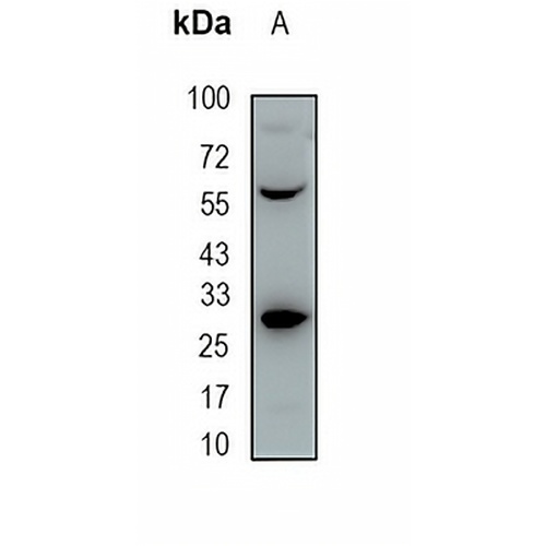 CDX1 Rabbit Monoclonal Antibody(C1907)