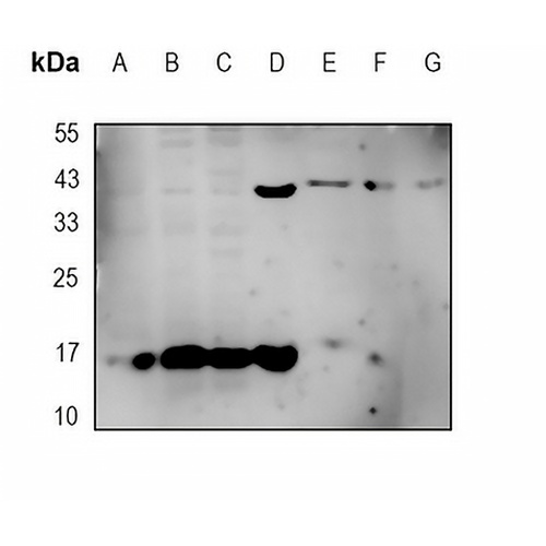 GDF3 Rabbit Monoclonal Antibody(C1908)