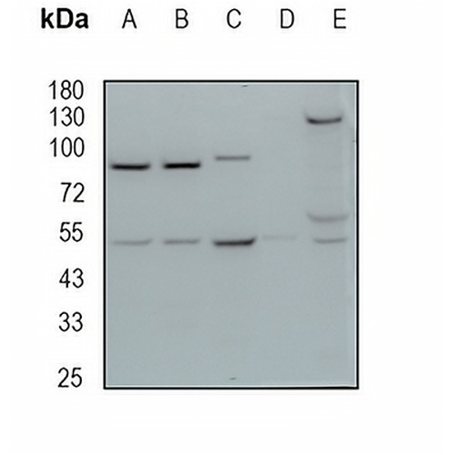 FOXL2 Rabbit Monoclonal Antibody(C1909)