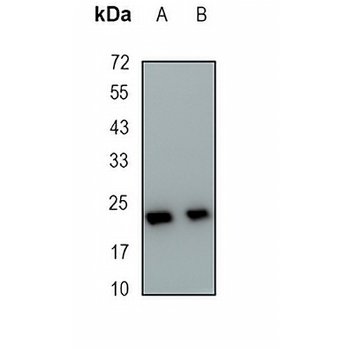 UBE2C Rabbit Monoclonal Antibody(C1910)